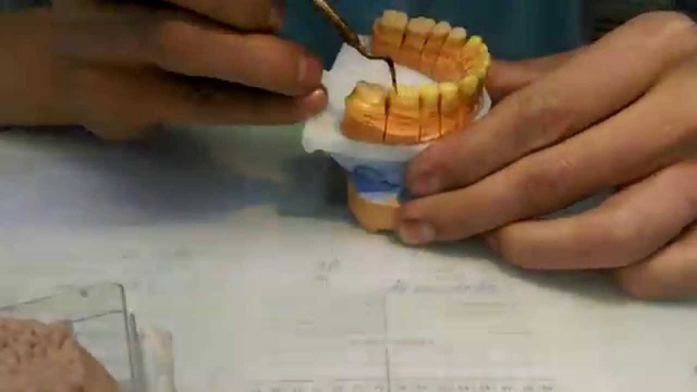 Wax Up Моделирование зубов воском 1