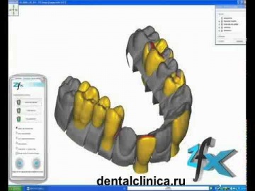 Анатомия улыбки: CAD CAM моделирование протезирование лечение зубов
