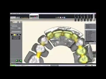 Цирконий система CAD-CAM/Zirkonzahn CAD_CAM.MP4
